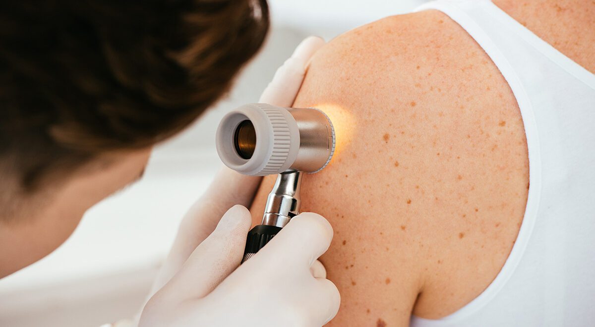 Bőr vizsgálat dermatoszkóppal kórházi környezetben.