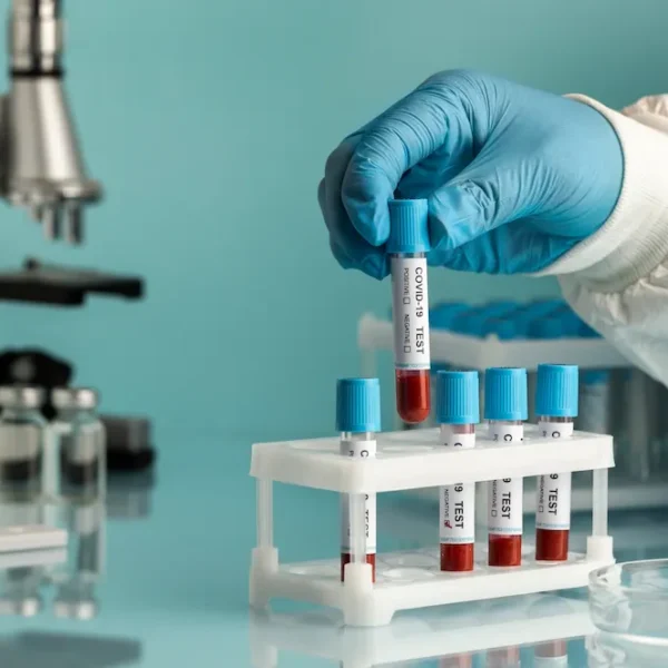 Kórházi laboratóriumi vizsgálat: vérminták elemzése mikroszkóp mellett.